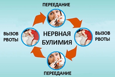 Лечение булимии в Зеленодольске